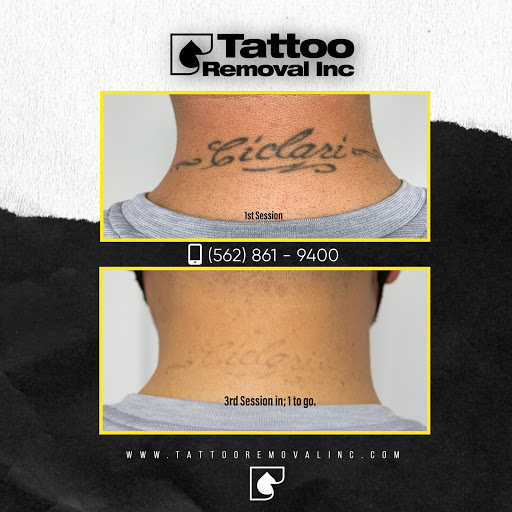 Explore grogu tattoo ideas, creative tattoo ideas in South Gate, available at Tattoo Removal Inc