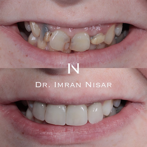 Dr. Imran Nisar - Dentist
