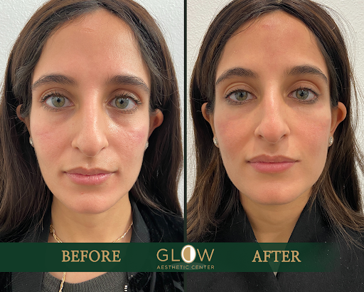 Glow Aesthetic Center Encino image