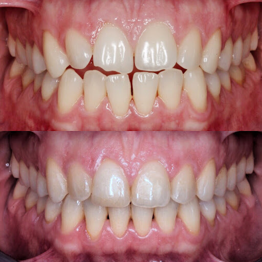 AE Clínica Dental | Gràcia | Ortodoncia | Rehabilitación oral | Implantes | Endodoncia | Blanqueamiento dental