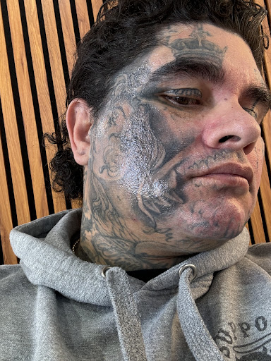 Explore tattoo ring ideas, creative tattoo ideas in Denver, available at Inkless Tattoo Removal