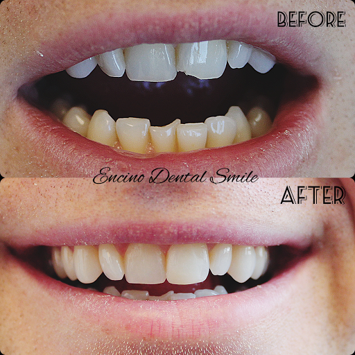 Encino Dental Smile image