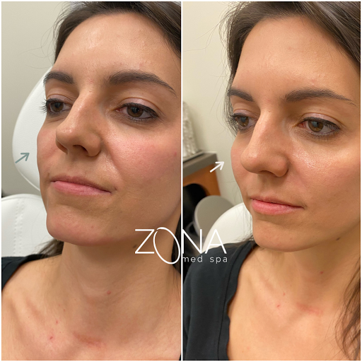 Skin Care Clinic «ZONA MED SPA», reviews and photos, 9767 N 91st St #102, Scottsdale, AZ 85258, USA