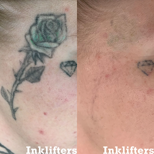 Explore martial arts tattoo ideas, creative tattoo ideas in Pleasant Grove, available at Inklifters Tattoo Removal