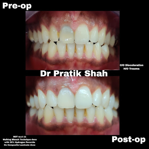 3A Dental Clinic - Kandivali - 3A Dental Clinic - Kandivali