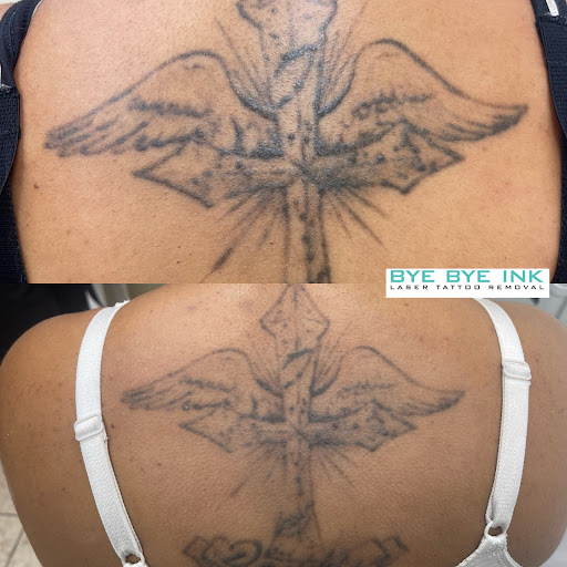 Explore good ideas for first tattoo, creative tattoo ideas in Middle Village, available at Bye Bye Ink Laser Tattoo Removal