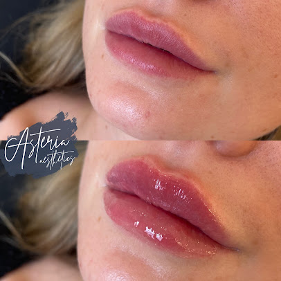 Astria جماليات - Astéria Aesthetics