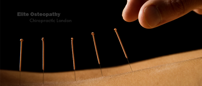 Elite Spine Clinic - Elite Spine Clinic