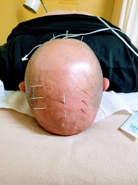 Happy mind body Spirit acupuncture - Photo 4 - Car repair in Torrance, CA, Long Beach