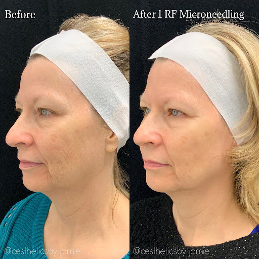 Explore calming tattoo ideas, creative tattoo ideas in Mesa, available at AZ Laser Studio & Medspa