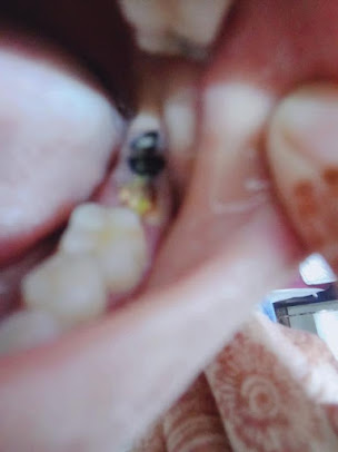 ADARSH DENTAL CLINIC - CHENNAI MRC Nagar - ADARSH DENTAL CLINIC - CHENNAI MRC Nagar