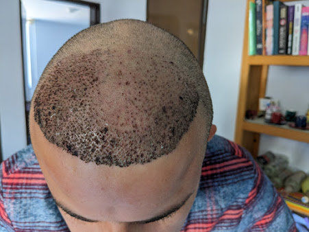 Hair in 1 Day Guadalajara - Hair in 1 Day Guadalajara