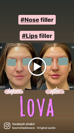 Explore astarion tattoo ideas, creative tattoo ideas in Lake Oswego, available at Lake Oswego Vein and Aesthetic LOVA