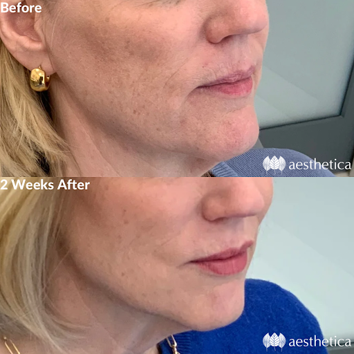 Explore 3 percent tattoo ideas, creative tattoo ideas in Pleasant Grove, available at Aesthetica