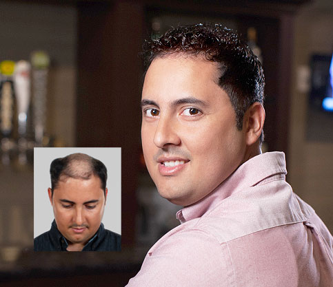 Hair Replacement Service «AVVAIR Styling and Hair Restoration Studio», reviews and photos, 5502 University Ave, Madison, WI 53705, USA