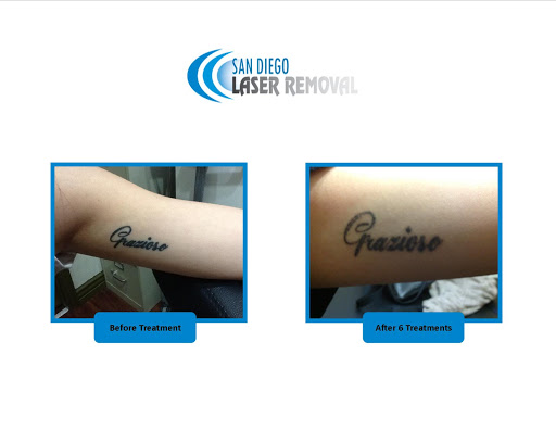 Explore tattoo pattern ideas, creative tattoo ideas in San Diego, available at Removery Tattoo Removal & Fading