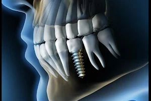 Family Dental Implant & orthodontic center FACIAL AESTHETIC SOLUTION image