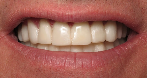 Bittner Family Dental Group image