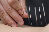 Aloha Acupuncture - Photo 7 - Car repair in Vista, CA, Oceanside