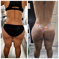 Ray Esthetics LLC Massage And Facials - Photo 3 - Car repair in Reading, PA, Reading