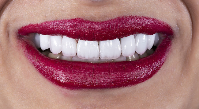 London Teeth Whitening - Dentist