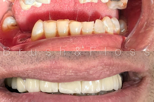 Brush and Floss Dental clinic and cosmetic center image