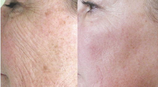 Explore sleeve tattoo ideas male, creative tattoo ideas in Anaheim, available at Neoderma