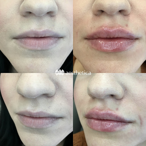 Explore attack on titan tattoo ideas, creative tattoo ideas in Pleasant Grove, available at Aesthetica