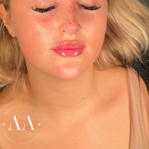 Arched Aesthetics | Lip Fillers & Aesthetic Treatments Plymouth - Doctor