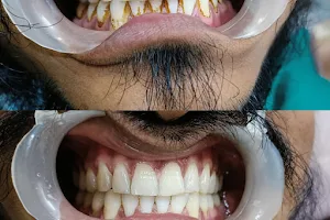 Dr. Charmi's Dental Clinic& Implant Center image