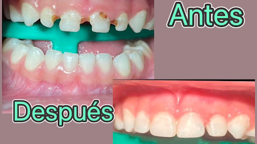 Endodoncista Tlaquepaque