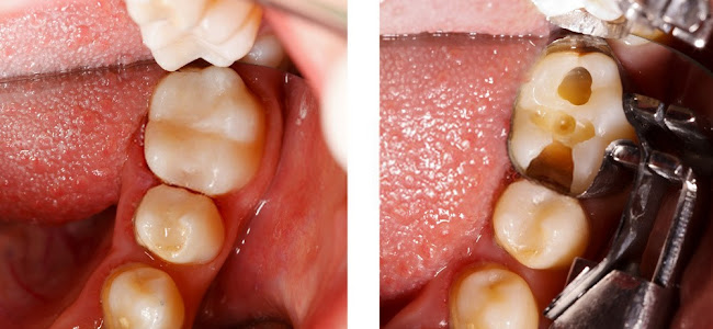 Horarios de Dr. Jorge Pizarro, Cirujano Dentista - Clínica Dental - Endodoncias