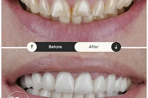 Özel DentaPoint Diş Polikliniği Bostanlı Şubesi - İmplant , Zirkonyum , Estetik Diş , Acil Diş , Kanal Tedavisi image