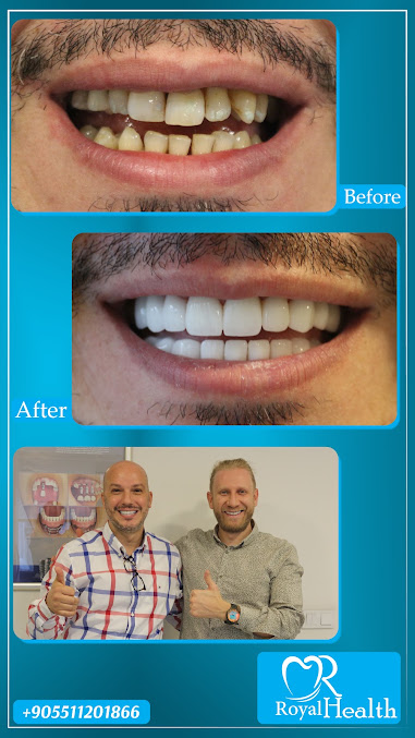 DentAtamer - DentAtamer