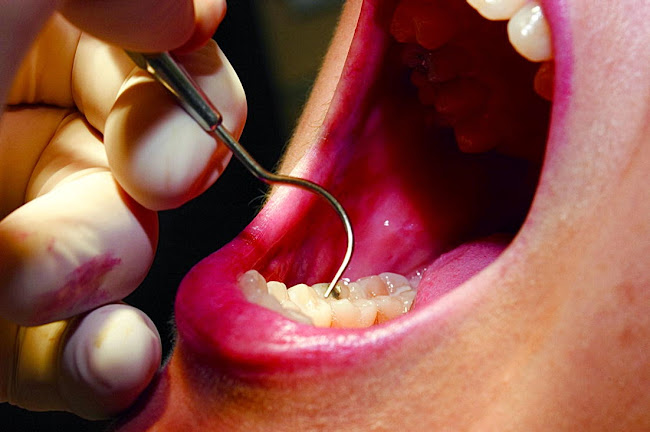 Reviews of Wishart Dental Centre in Porirua - Dentist