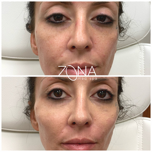 Skin Care Clinic «ZONA MED SPA», reviews and photos, 9767 N 91st St #102, Scottsdale, AZ 85258, USA