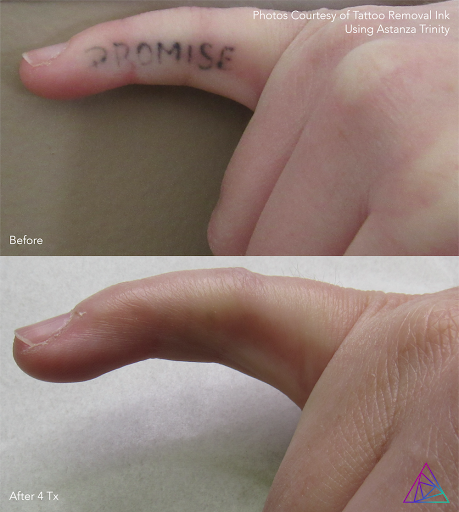 Explore david and goliath tattoo ideas, creative tattoo ideas in Minneapolis, available at Creative Re-Imaging