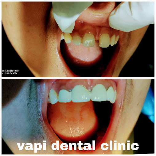 RAS Dental clinic and Implant centre - RAS Dental clinic and Implant centre