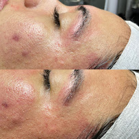 Brilla Esthetics - Photo 2 - Car repair in Salinas, CA, Salinas