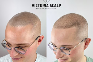 Victoria Scalp Micropigmentation