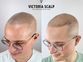 Victoria Scalp Micropigmentation