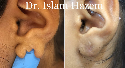 Dr. Hazem Mokhaimer - Dr. Hazem Mokhaimer