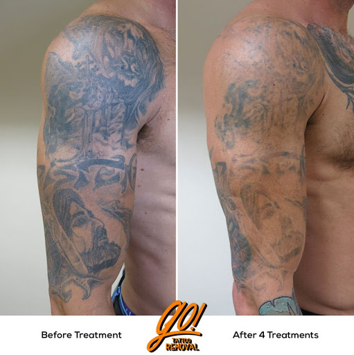 Explore man tattoo ideas arm, creative tattoo ideas in Allentown, available at Removery Tattoo Removal & Fading