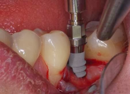 Clinica Dental Dr. Aravena - Dentista