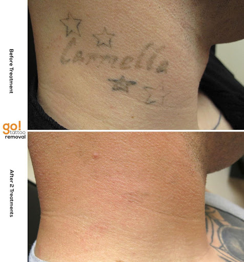 Explore portugal tattoo ideas, creative tattoo ideas in Allentown, available at Removery Tattoo Removal & Fading