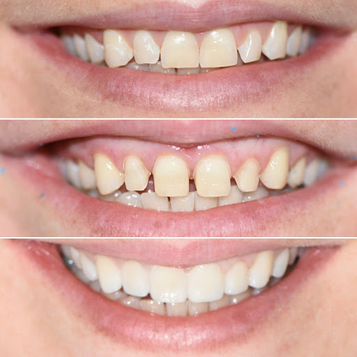 Dental implants provider Frisco