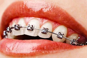 Orthodontic Clinic Etawah टेढ़े मेढे दाँतों का अस्पताल Best Dental Clinic & Best Dentist Top In Etawah, Auraiya, Mainpuri image