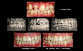 Ortodoncia Dr. Luis M. Costales