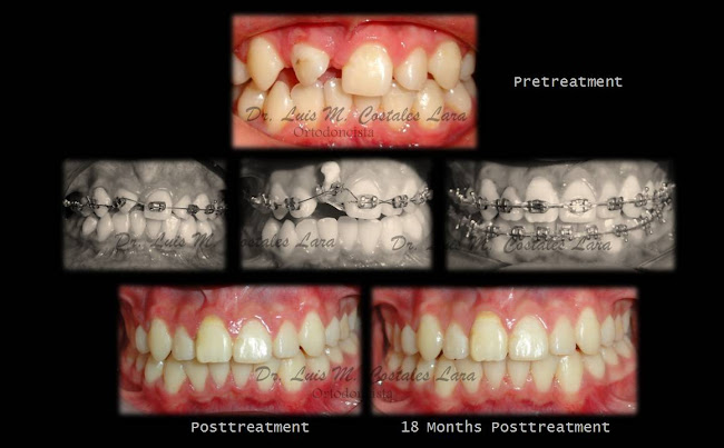 Ortodoncia Dr. Luis M. Costales