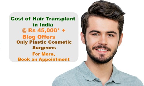 Hair Transplant Indian